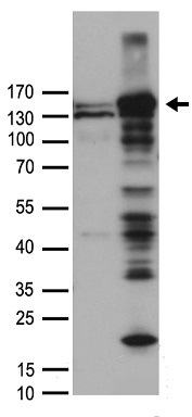 OIP5 Antibody