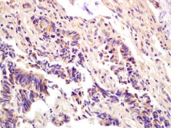 ompF antibody