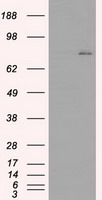 OSM Antibody