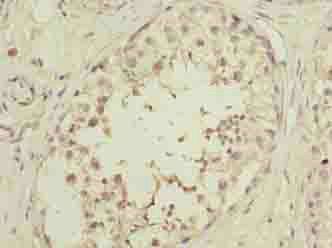 OOSP2 Antibody