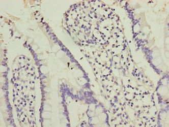 OOSP2 Antibody