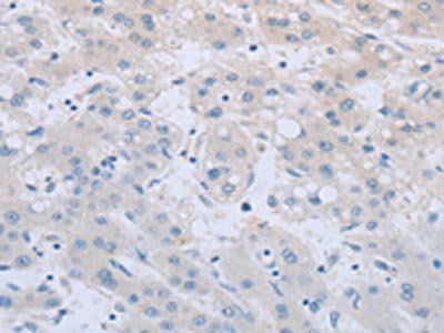 TNFRSF11B Antibody