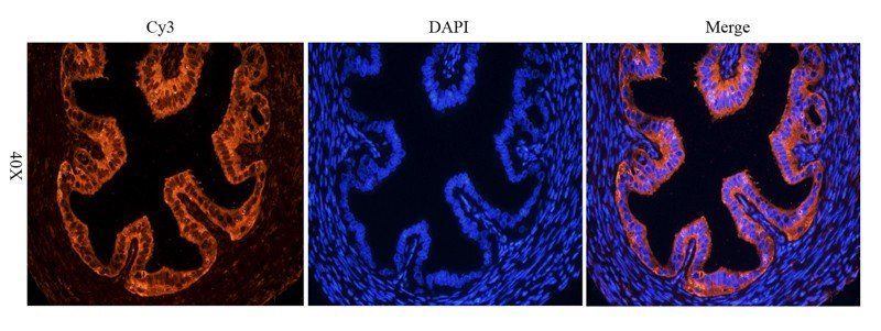 OPG antibody