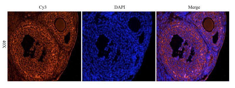 OPG antibody