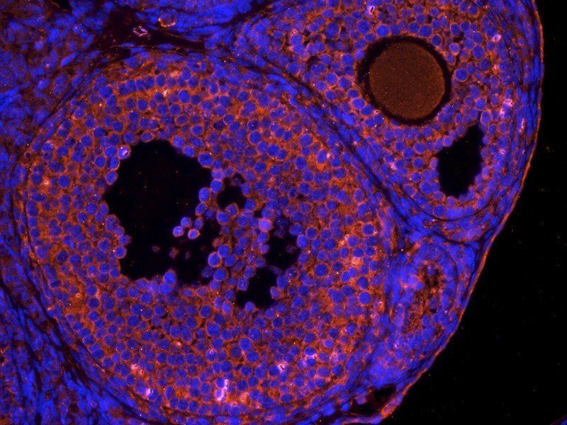 OPG antibody