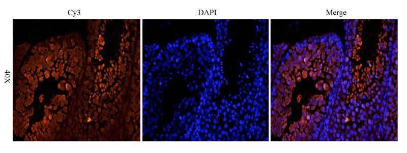 OPG antibody