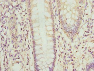 OPHN1 Antibody