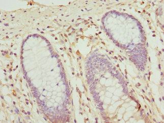 OPHN1 Antibody