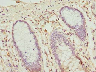 OPHN1 antibody