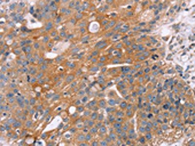 OPTN Antibody