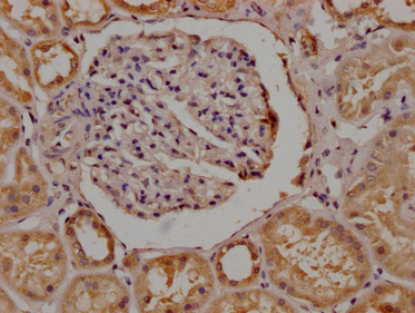 OR4C15 Antibody