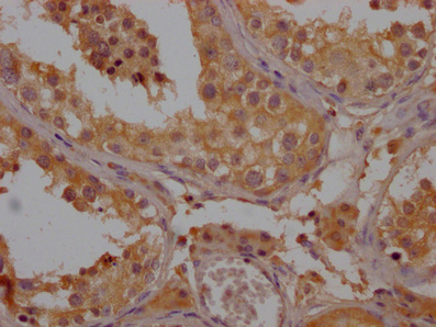 OR52B6 Antibody