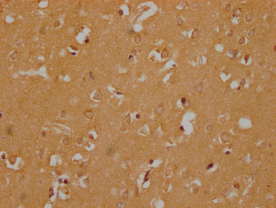 OR6B3 Antibody