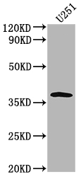OR6B3 antibody