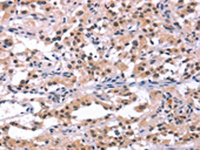 ORAI1 Antibody