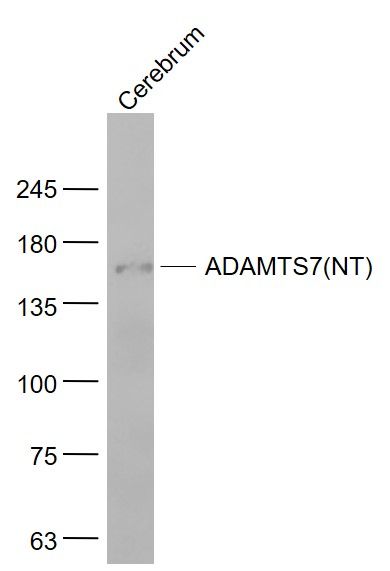 ADAMTS7 antibody