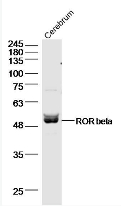 RORB antibody