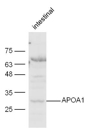 Apolipoprotein AI antibody