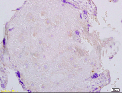 Fibrillin 1 Rabbit Polyclonal Antibody