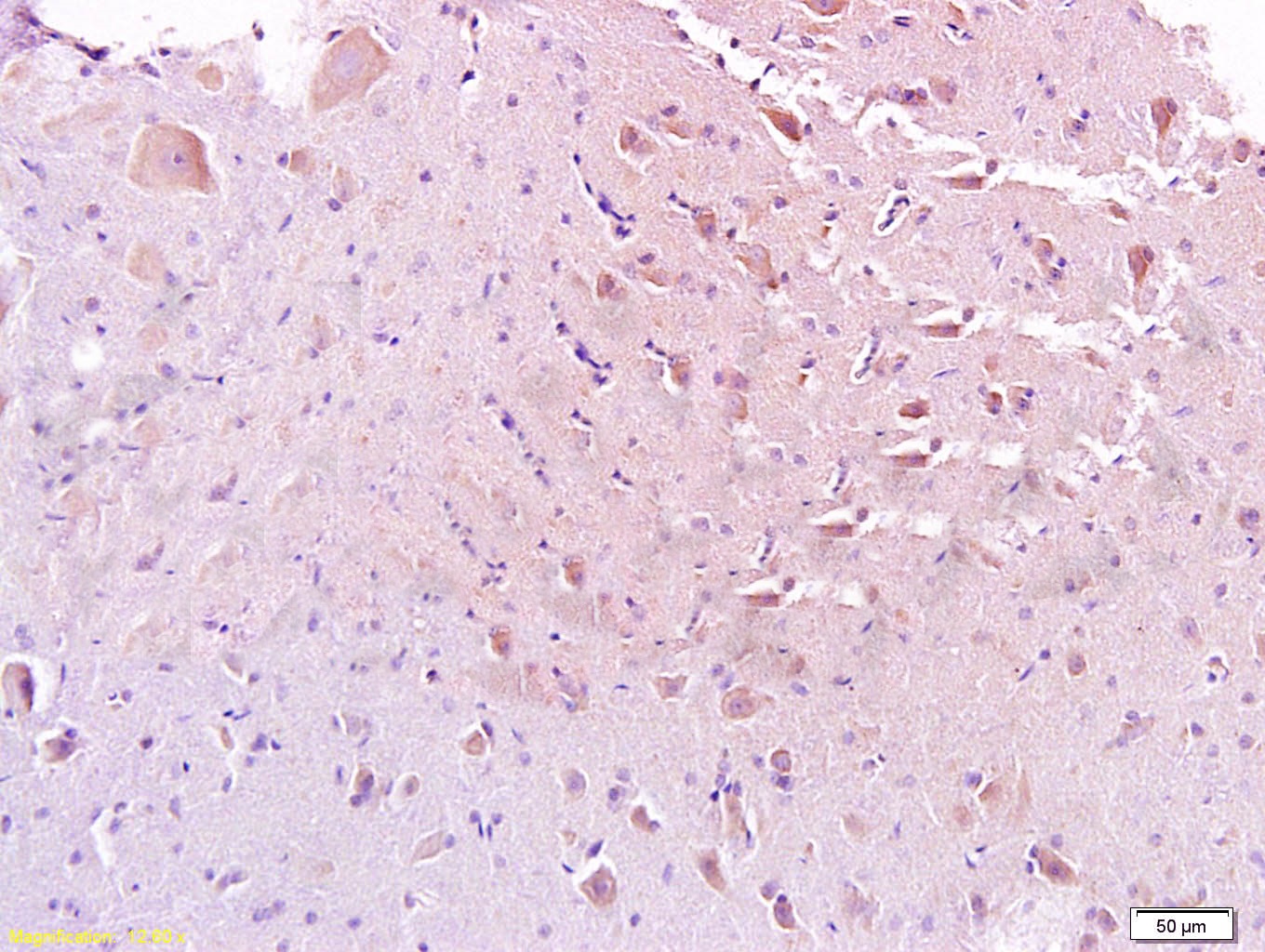 GAL Mouse Polyclonal Antibody