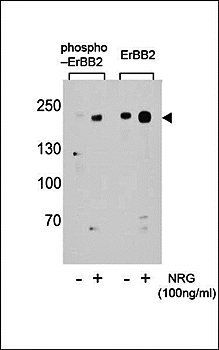 Phospho-ERBB2-S1151 antibody