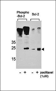 BCL2 (Phospho-S70) antibody