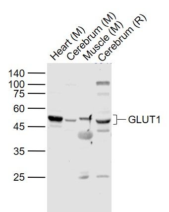GLUT1 antibody