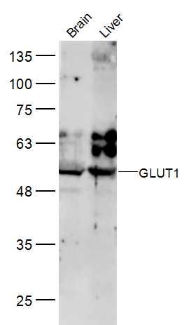 GLUT1 antibody