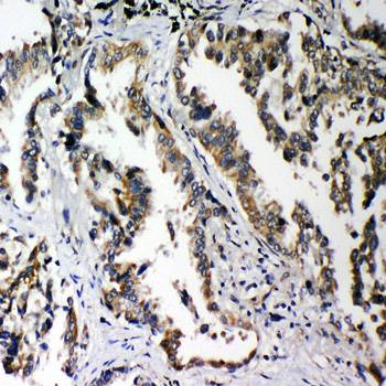 Anti-PLK2 Antibody