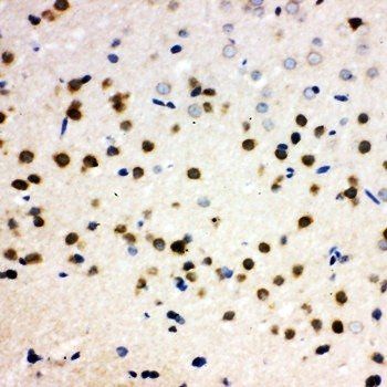 Anti-PLK2 Antibody