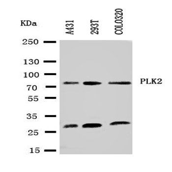 Anti-PLK2 Antibody