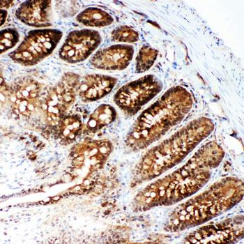 Anti-VCP Antibody
