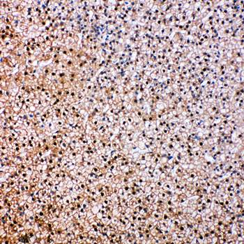 Anti-VCP Antibody