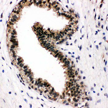 Anti-VCP Antibody