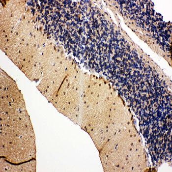 Anti-VCP Antibody