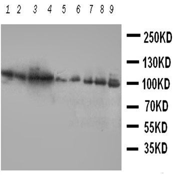 Anti-VCP Antibody