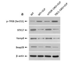 Phospho-TFEB (Ser211) Antibody