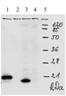 Mouse monoclonal antibody to HPV-18 E7