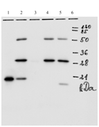 Mouse monoclonal antibody to HPV-18 E7