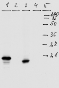 Mouse monoclonal antibody to HPV-18 E7