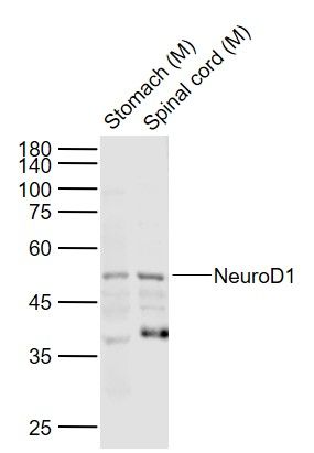NeuroD1 antibody