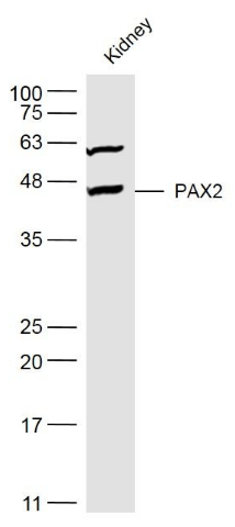 PAX2 antibody