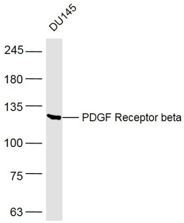 PDGFR beta antibody