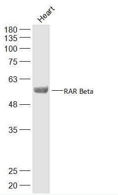 RAR beta antibody