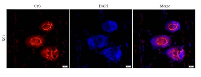 Reelin antibody