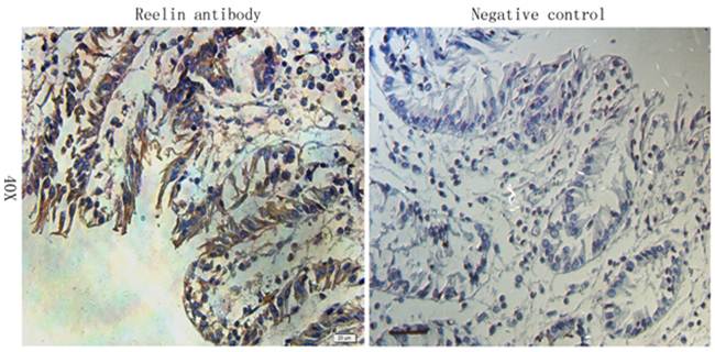 Reelin antibody