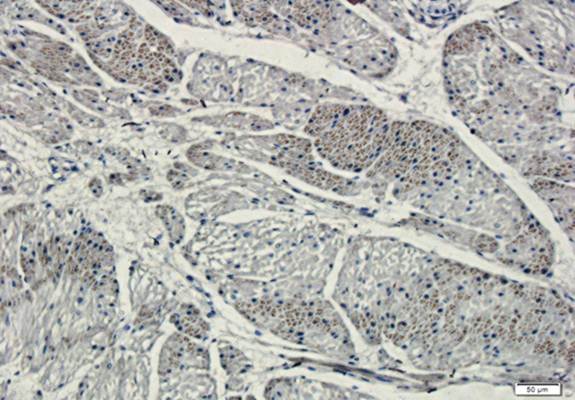 TIMP1 antibody