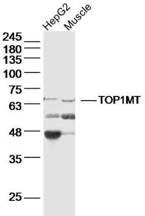 Topoisomerase I antibody