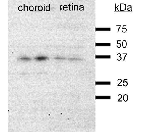 VEGF antibody