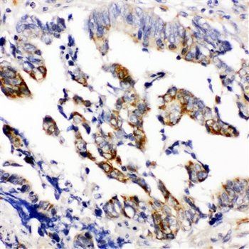 Anti-Beta Arrestin 2/ARRB2 Antibody